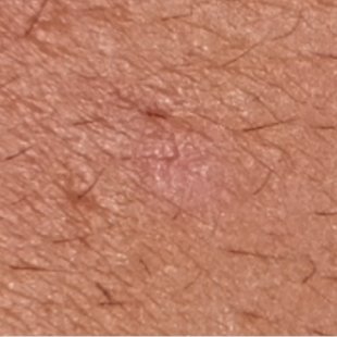 Effaclar duo plus m