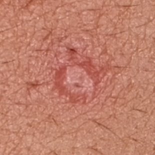 effaclar