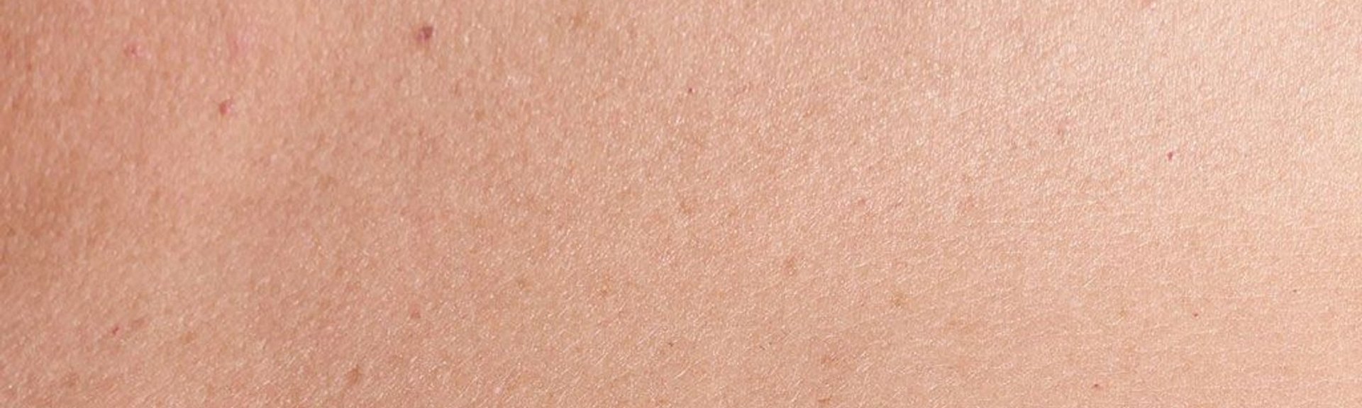 sensitive skin