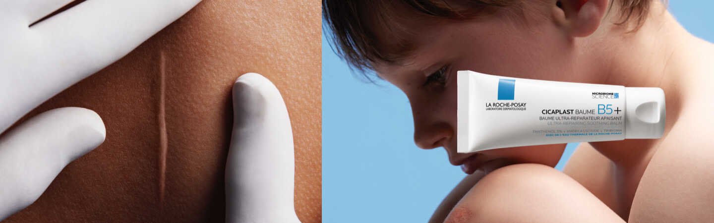 CICAPLAST