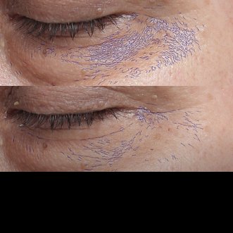 Hyalu Β5 Serum: Η Εξέλιξη της Αντιγήρανσης, μέσω της Επανόρθωσης