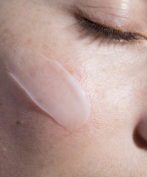 Allergy Image