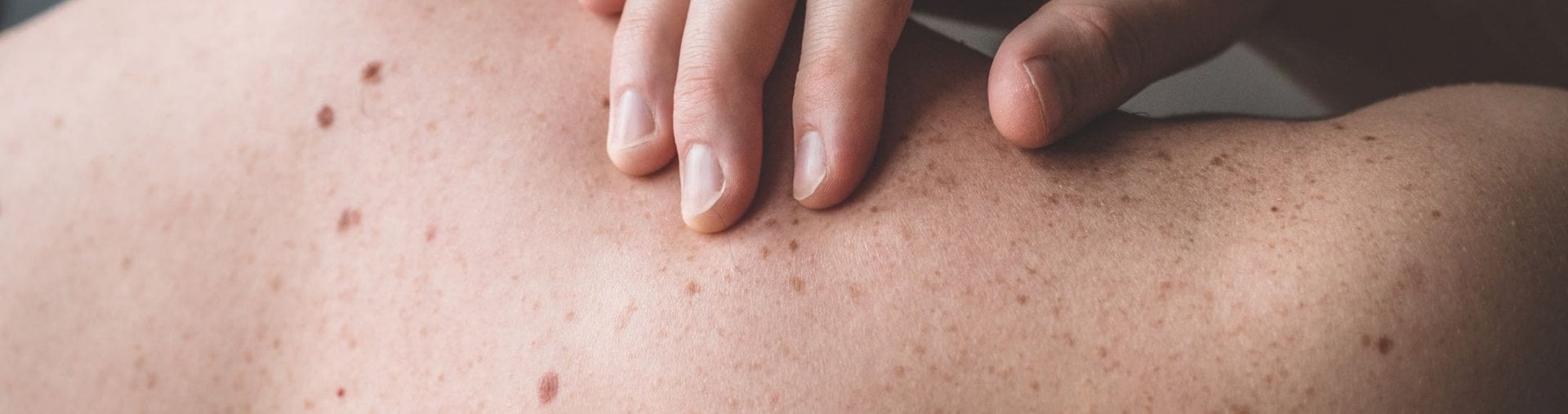 Οncology banner la roche posay