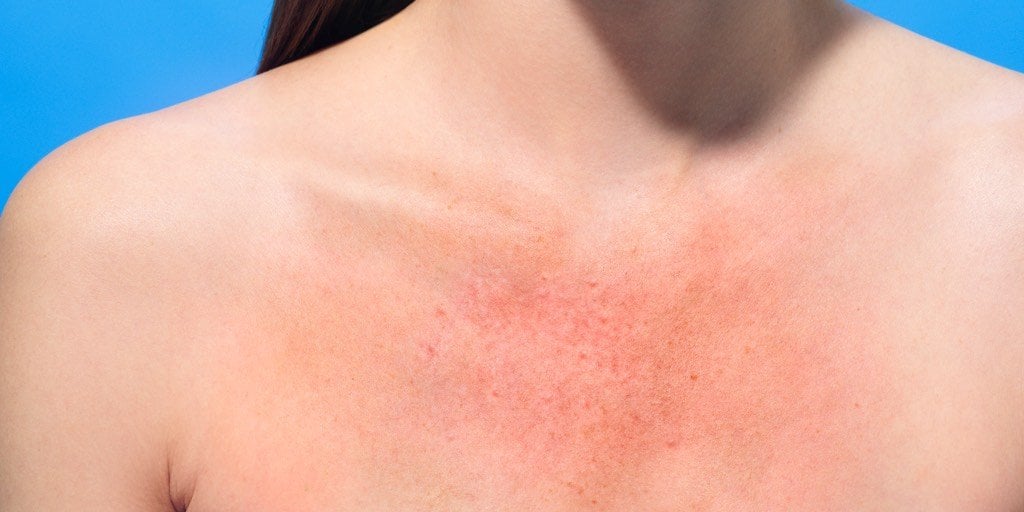 Protecting my skin banner