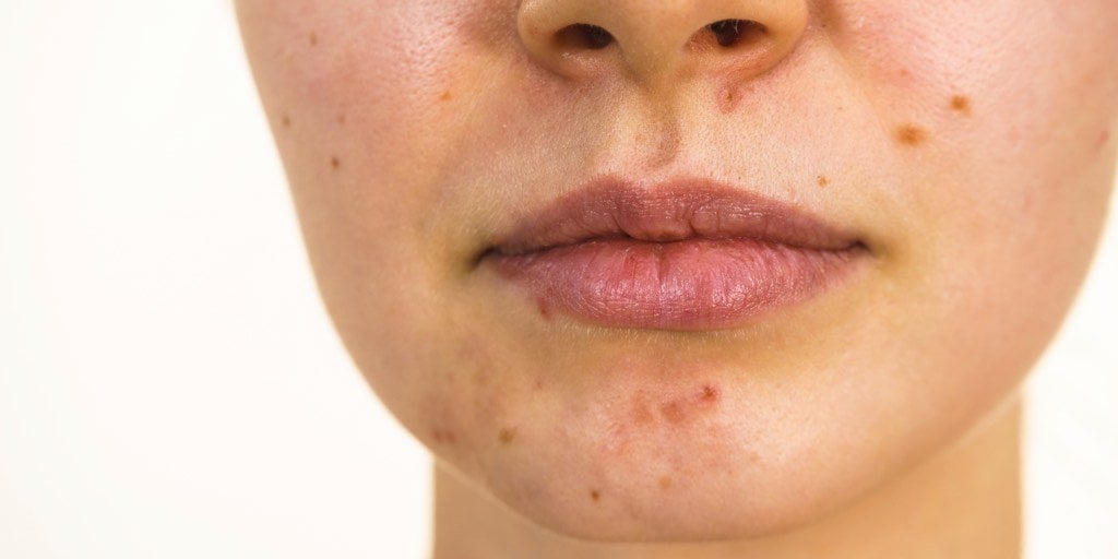 Protecting my skin banner