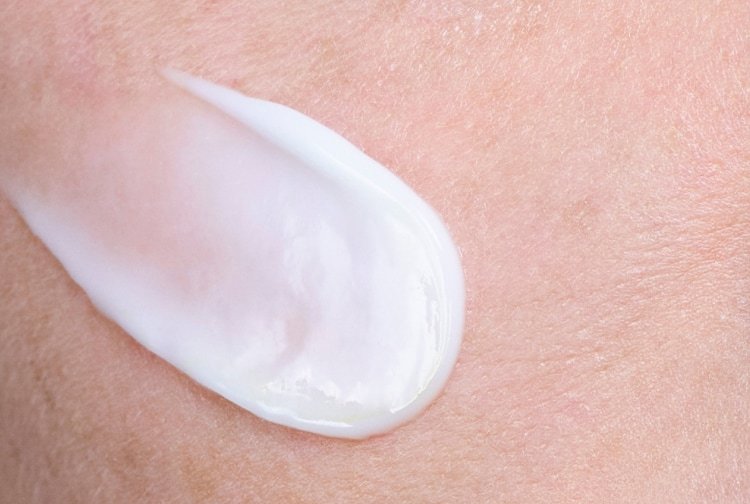 Hyperpigmentation